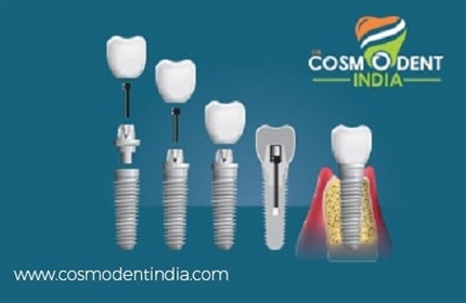 dental-implant-preparation-stages-results