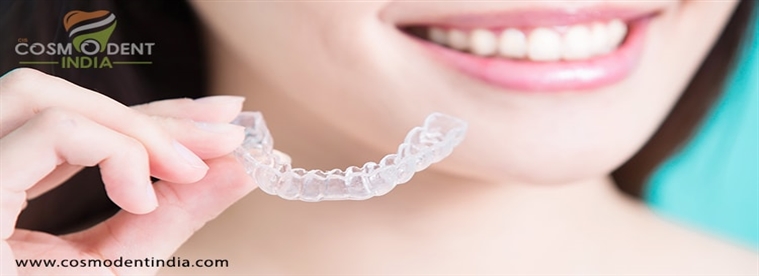 invisible-braces-clear-aligners-for-beautiful-smile