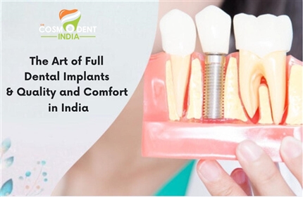 the-art-of-full-dental-implants-quality-and-comfort-in-india