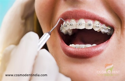 an-insight-into-orthodontic-treatment