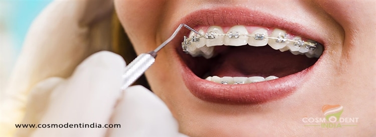 un tratamiento de ortodoncia