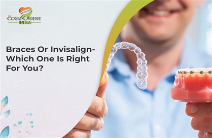 braces-or-invisalign-which-one-is-right-for-you