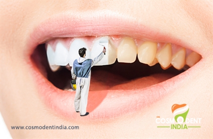 what-are-the-different-types-of-cosmetic-dental-treatment