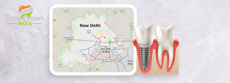 أفضل علاج الأسنان زرع مركز في دلهي