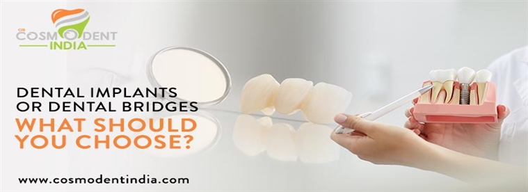 dental-implants-or-dental-bridges-what-should-you-choose