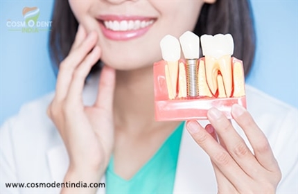 dental-implants-solution-to-your-missing-teeth