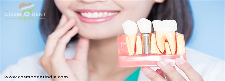 dental-implants-solution-to-your-missing-teeth