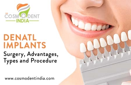 dental-implants-surgery-advantages-types-and-procedure