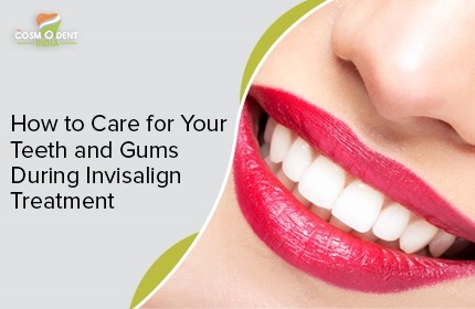 how-to-care-for-your-teeth-and-gums-during-invisalign-treatment