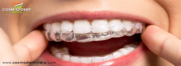 invisalign-braces-treatment-in-india