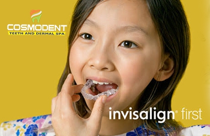 invisible-braces-for-kids