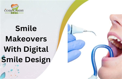 smile-makeovers-with-digital-smile-design