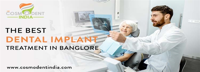el-mejor-tratamiento-de-implantes-de -ntales-en-bangalore