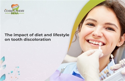 the-impact-of-diet-and-lifestyle-on-tooth-discoloration