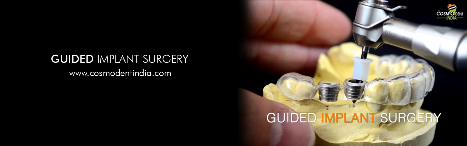 guided-implant-surgery
