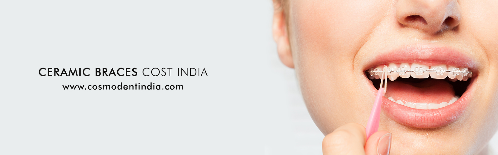 ceramic-braces-cost-india