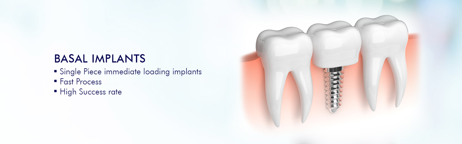 dientes permanentes con implantes basales en india