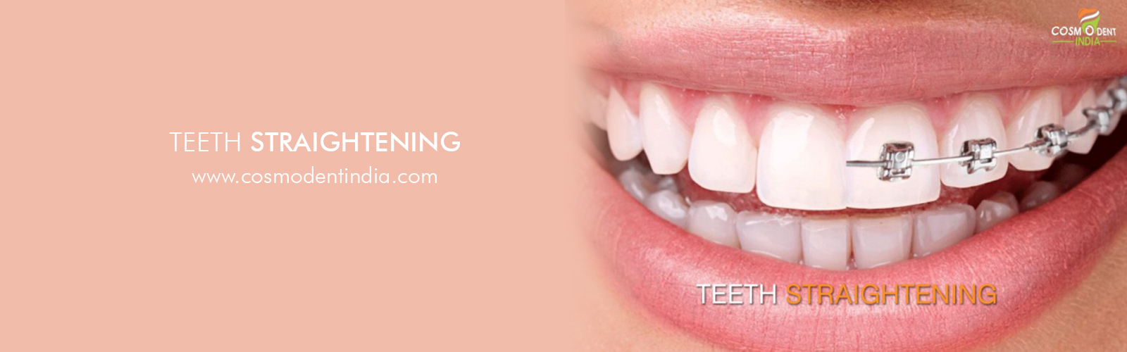 teeth-straightening