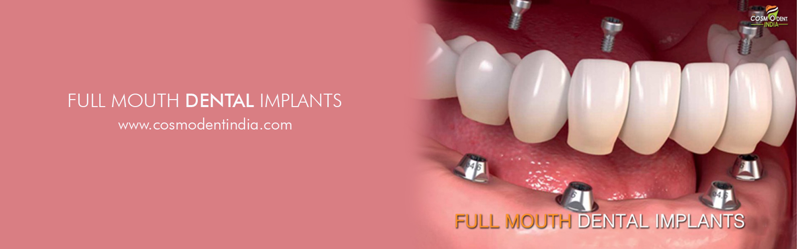 Teeth Repair Kit, Temporary Teeth replacement kit, India