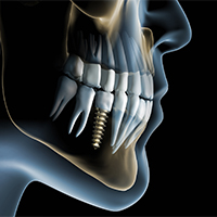 dental-clinic-in-gurgaon