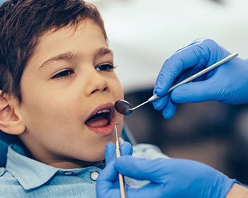 dental-braces-in-india