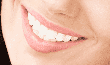 teeth-braces-cost-in-india