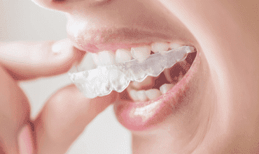 tooth-implant-cost-in-gurgaon